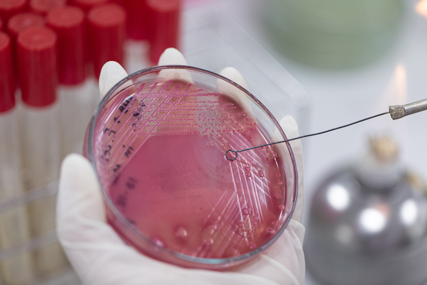 Both Prevention and Adaptation Are Vital to Avert a Global Health Crisis in Antimicrobial Resistance